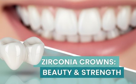 Zirconia Crown: A Modern Dental Solution for Your Smile