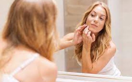 Isotretinoin for Acne: The Secret to Clean, Radiant Skin