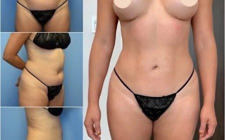 Body Contouring in Dubai: A Breakthrough in Body Sculpting Technology