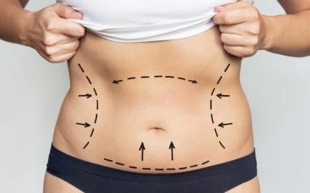 Best Liposuction Surgeons in Dubai Break Down Liposuction Basics