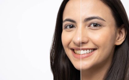 Zoom Whitening in Riyadh: The In-Office Treatment Making Smiles Camera-Ready