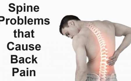 Spine Problems that Cause Back Pain