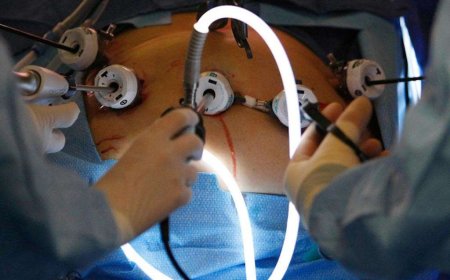 Complications & Recovery After Weight Loss Surgery