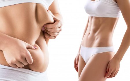 Pain-Free Liposuction Surgery in Dubai The Role of Anesthesia