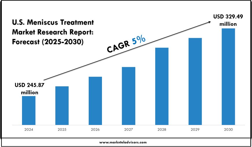 U.S. Meniscus Treatment Market Analysis by Size, Revenue & Key Players