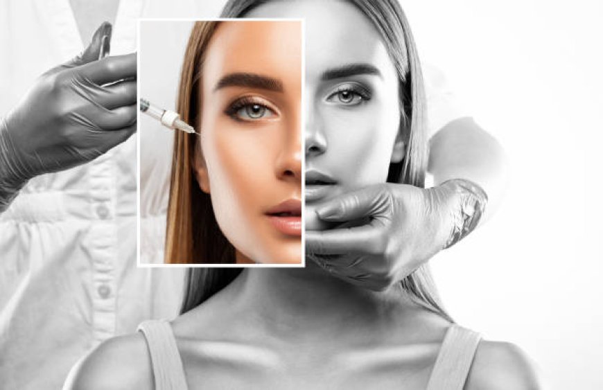 Botox Injections FAQs: Answers to Your Most Common Questions
