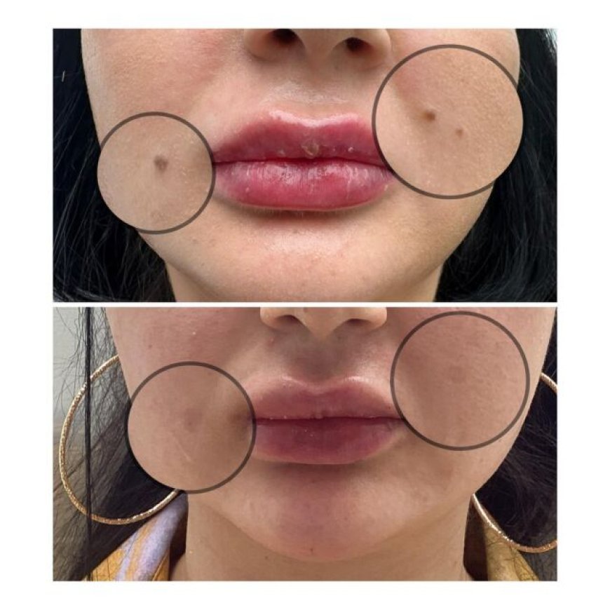 Why a Richmond Skin Clinic is Your Path to Healthy, Beautiful Skin