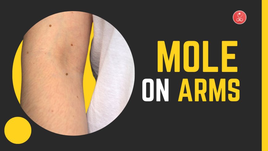 Mole on Arms: Meanings, Health Risks & Spiritual Insights